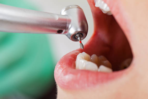 Best Emergency Treatment for Toothache in Warsaw, IL